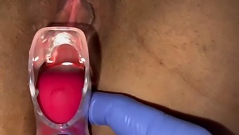 A Gynecologist Uses A Speculum To Examine A Woman'S Orgasm And Ejaculation